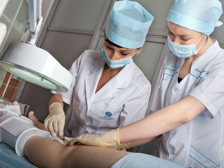 Ablația cu laser a venelor varicoase